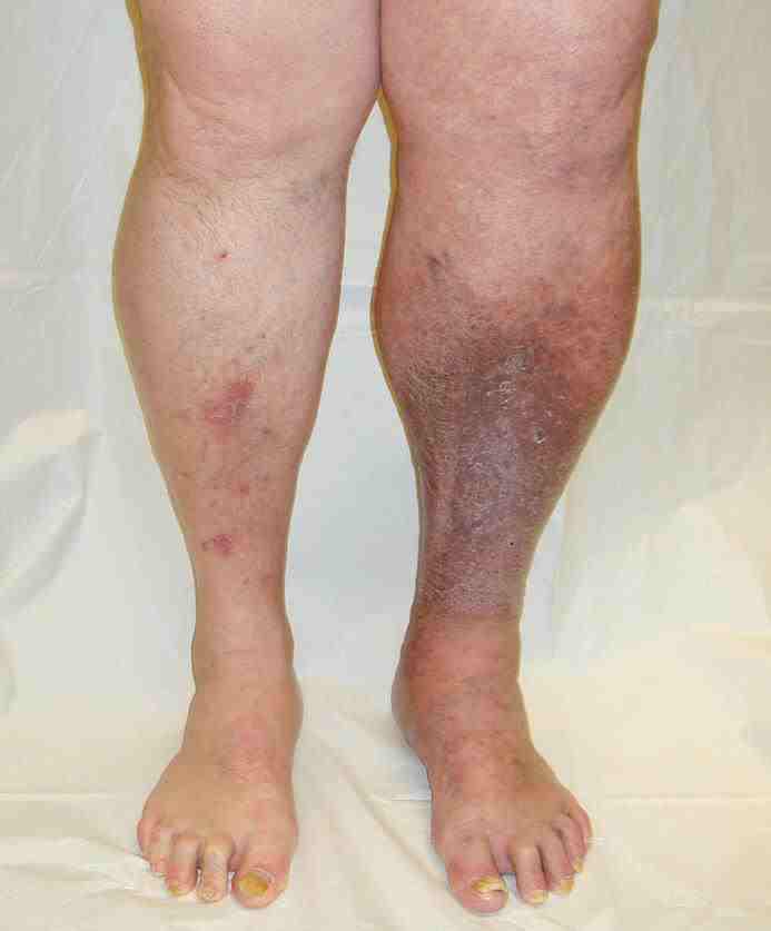 bariatric3602021_497853586938592_1502194772_n